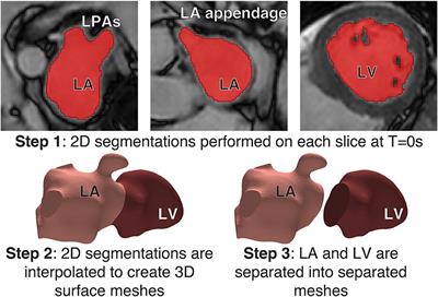 Modeling Left Atrial Flow, Energy, Blood Heating Distribution in Response to Catheter Ablation Therapy